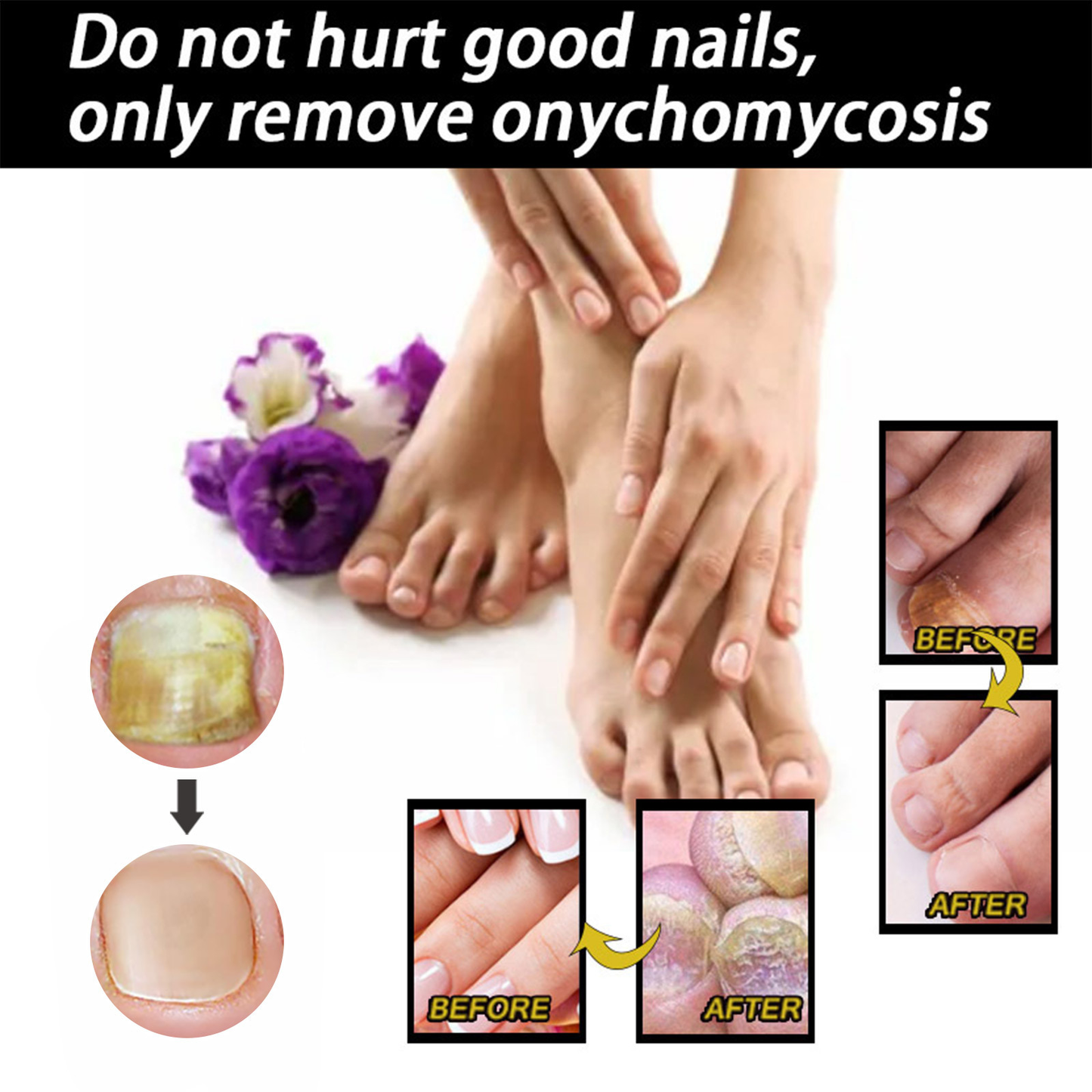 Fast Nail Fungal Repair Essences Serum Care Foot Nail Fungus Removal