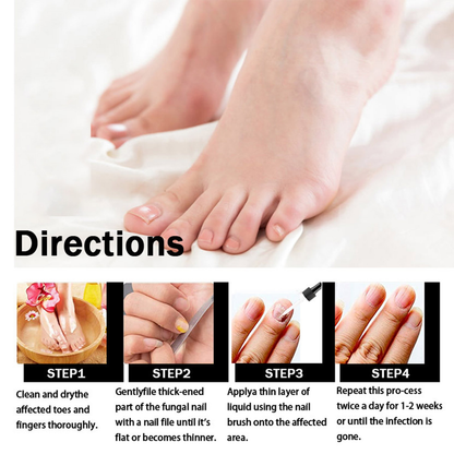 Fast Nail Fungal Repair Essences Serum Care Foot Nail Fungus Removal