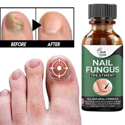 Fast Nail Fungal Repair Essences Serum Care Foot Nail Fungus Removal